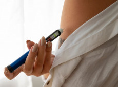 Sociedades médicas criticam decisão da Conitec de barrar canetas emagrecedoras no SUS, apontando elitização do tratamento da obesidade no Brasil.