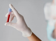 Novo exame de sangue detecta Alzheimer com 94,5% de precis&atilde;o e antes da perda de mem&oacute;ria
